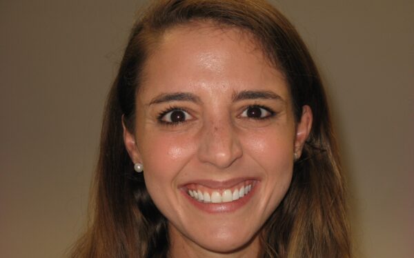 image of lady before treatment