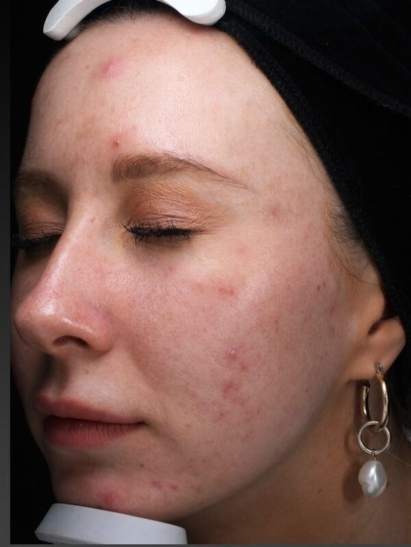 image of lady before clinic