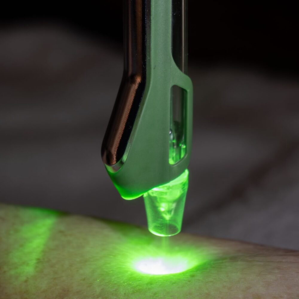 Jet LED Green simultaneous treatment close up Woodford Medical Belfast