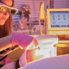 Image of therapists performing BBL treatment