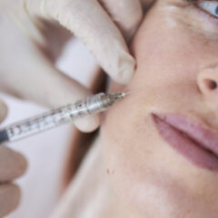 image of lady having Profhilo injections