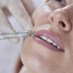 Lip filler