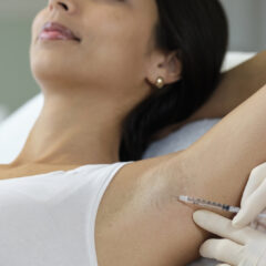 lady having armpit injected