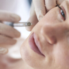 lady having facial fillers